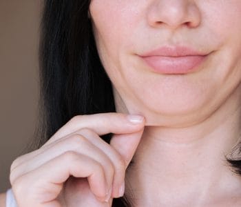 بروتوكول شد الوجه في إسطنبول | Mediplast