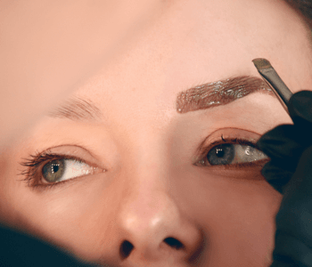 إجراء تصفيح الحواجب