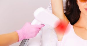 Lazer epilasyon sonrası cilt hassasiyeti ve kızarıklık oluşumu