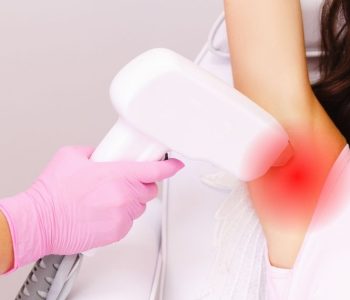 Lazer Epilasyon Sonrası Cilt Hassasiyeti | Mediplast